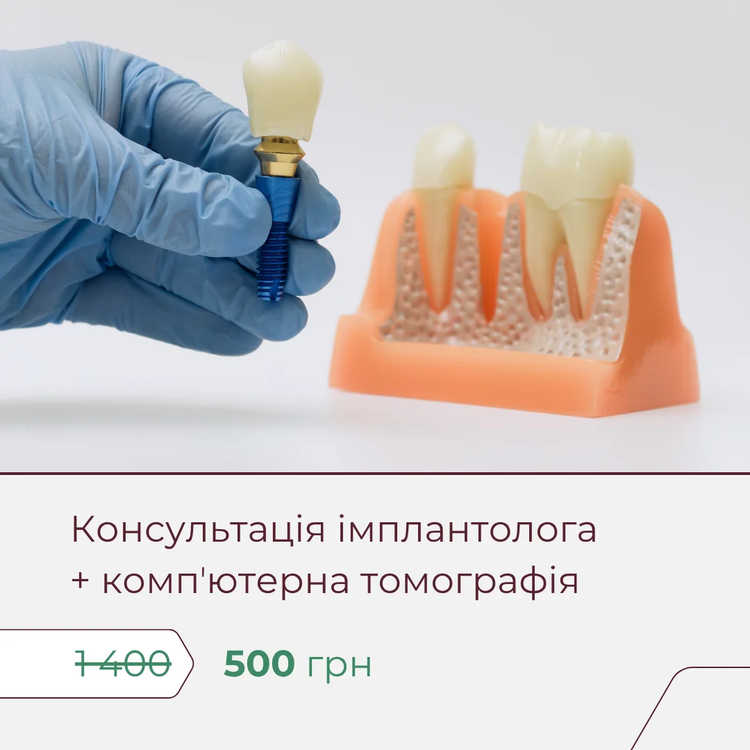 Консультація стоматолога-імплантолога + КТ — всього 500 грн 1 картинка