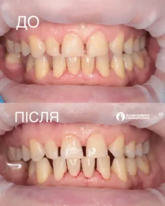 Кавчак Марина Степановна 1025 картинка kavchak-result_03