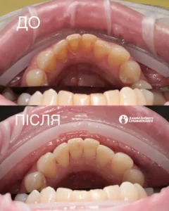Кавчак Марина Степановна 1026 картинка kavchak-result_04