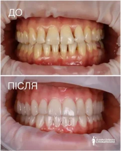 Кавчак Марина Степановна 1030 картинка kavchak-result_08