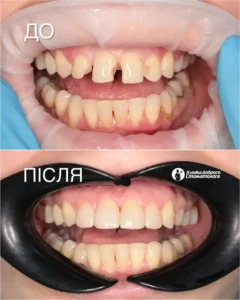 Кавчак Марина Степановна 1031 картинка kavchak-result_09