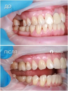 Хижняк Вячеслав Иванович 295 картинка khizhnyak-result_03